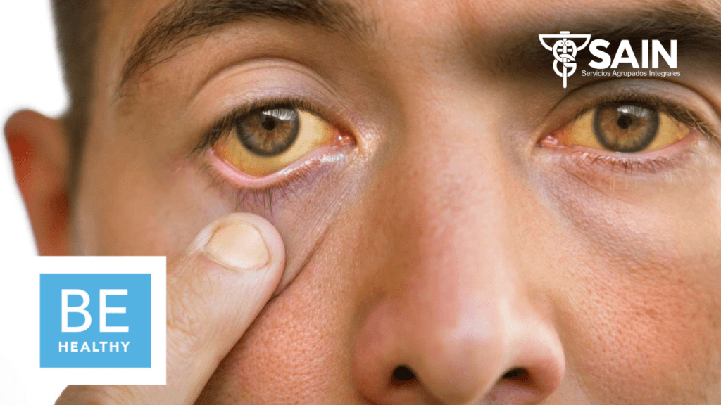 Understanding Hepatitis: Awareness, Prevention, and Treatment